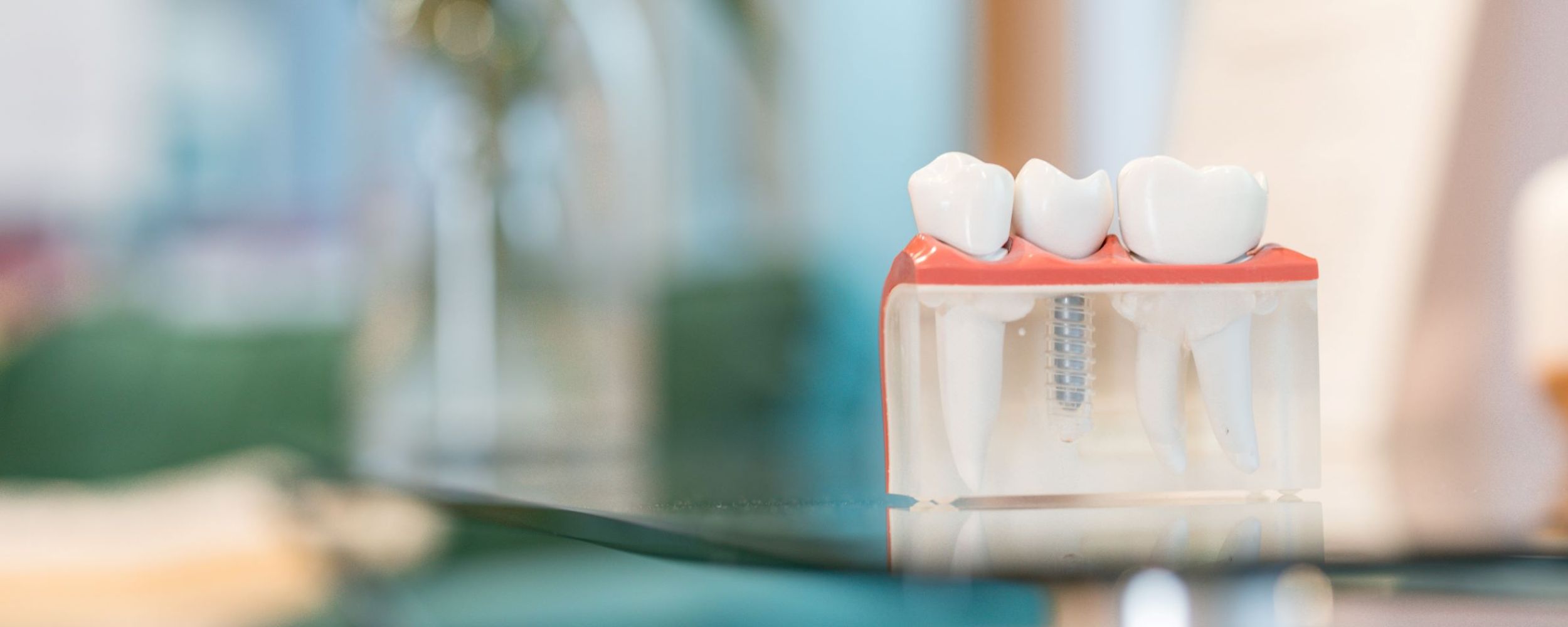 Dental implant journey