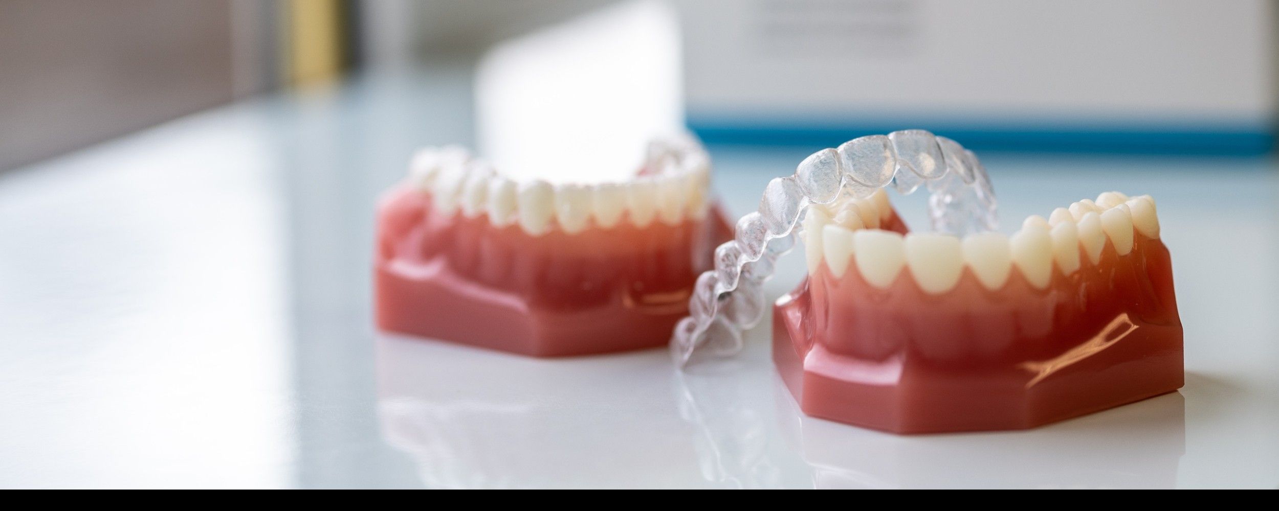 Invisalign clear aligners. 